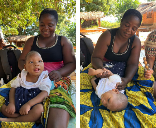 Anele is making progress with physiotherapy